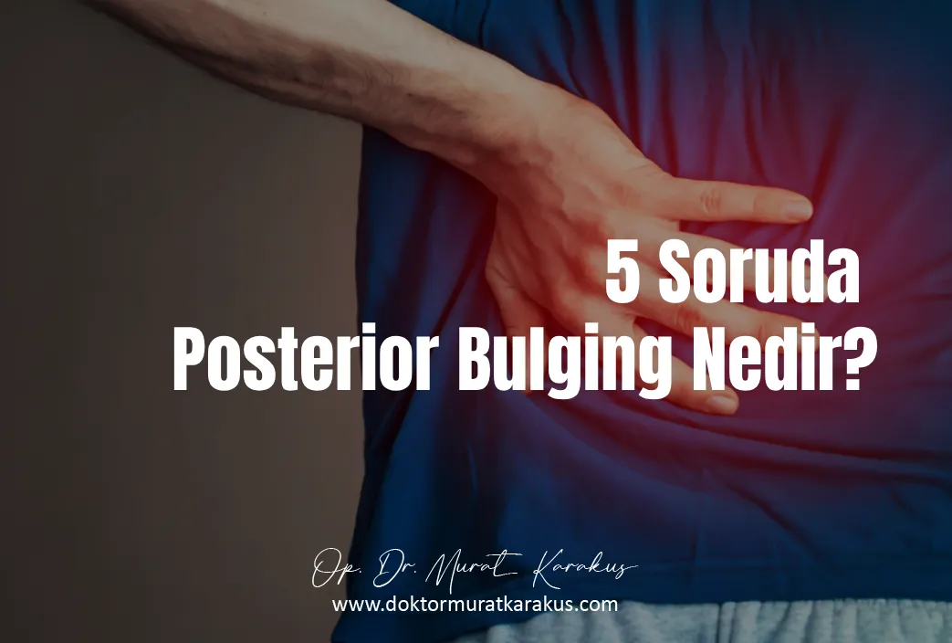 5-soruda-posterior-bulging-nedir-1043x704