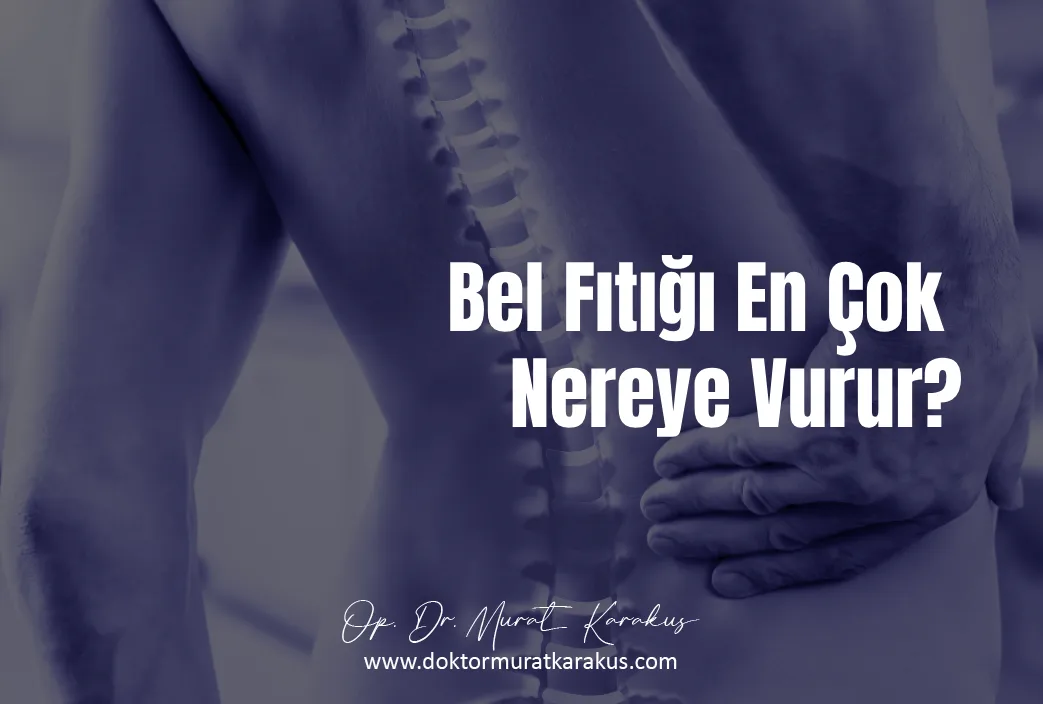 bel-fitigi-en-cok-nereye-vurur