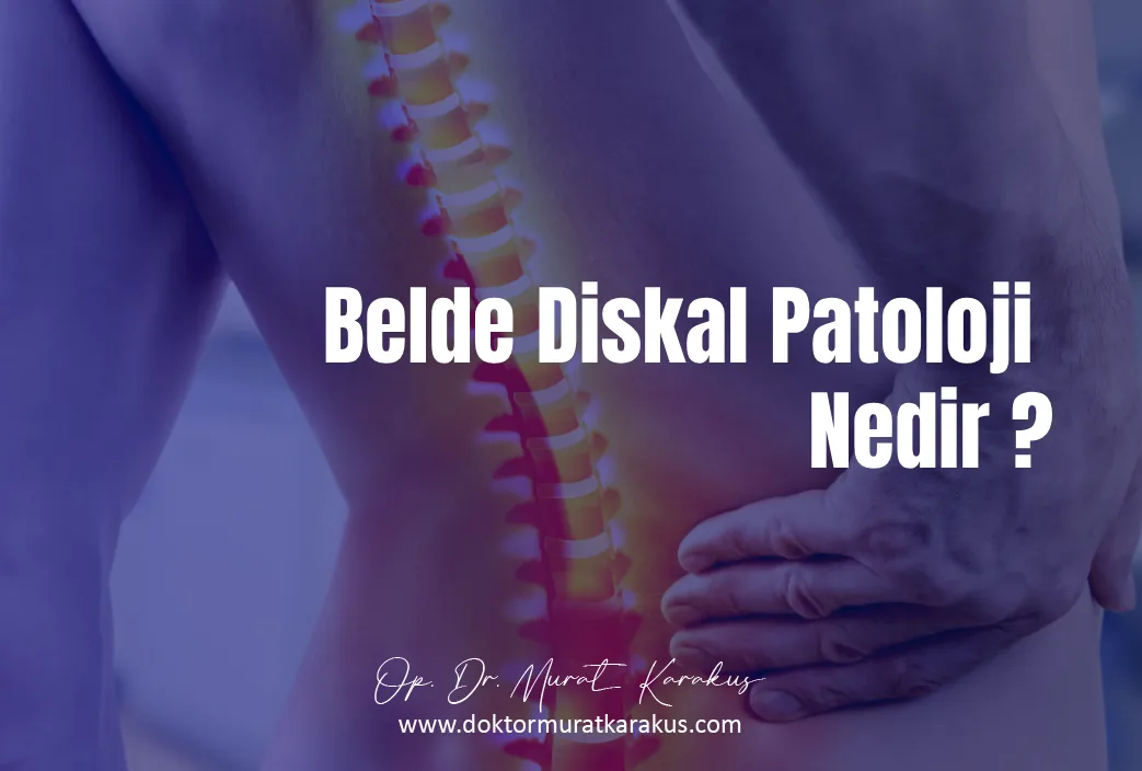 Belde Diskal Patoloji Nedir ? 7 Belirtisi