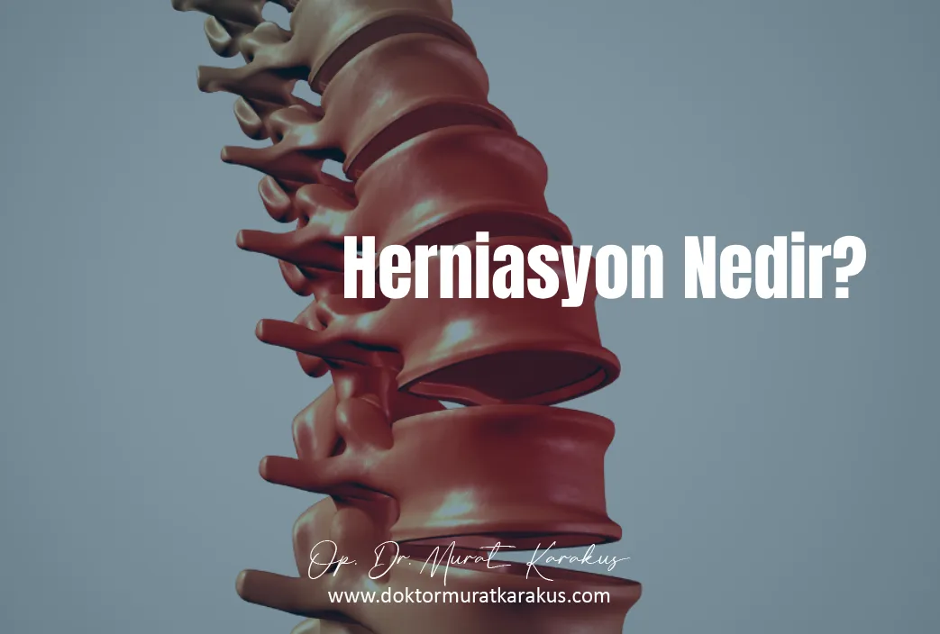 herniasyon-nedir-