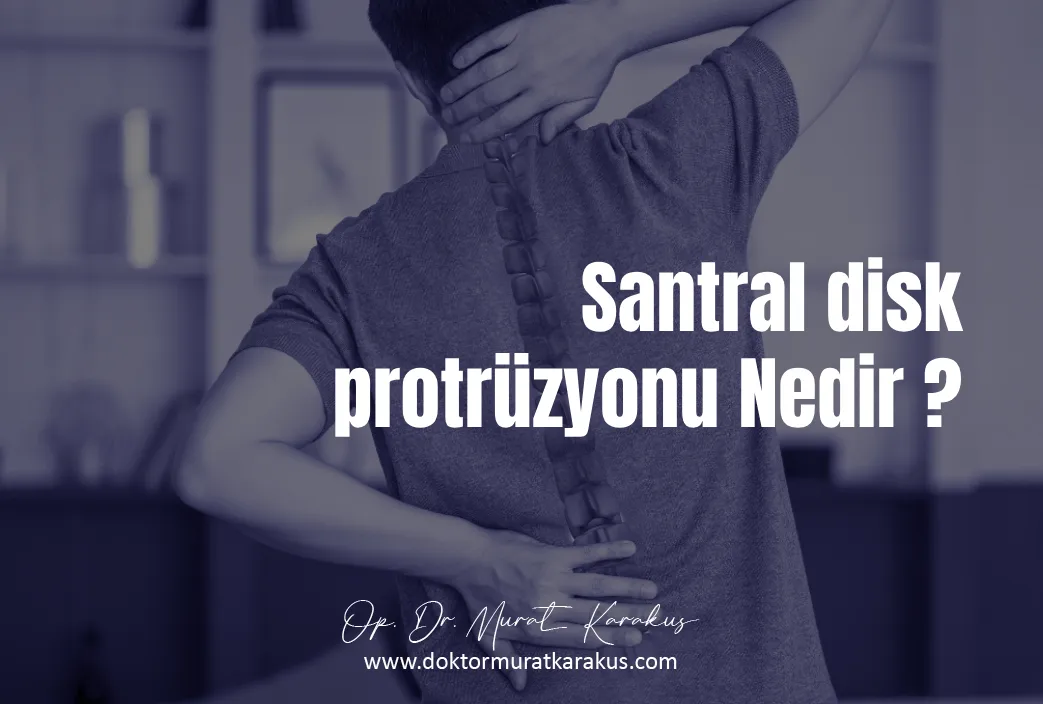 santral-disk-protruzyonu-nedir
