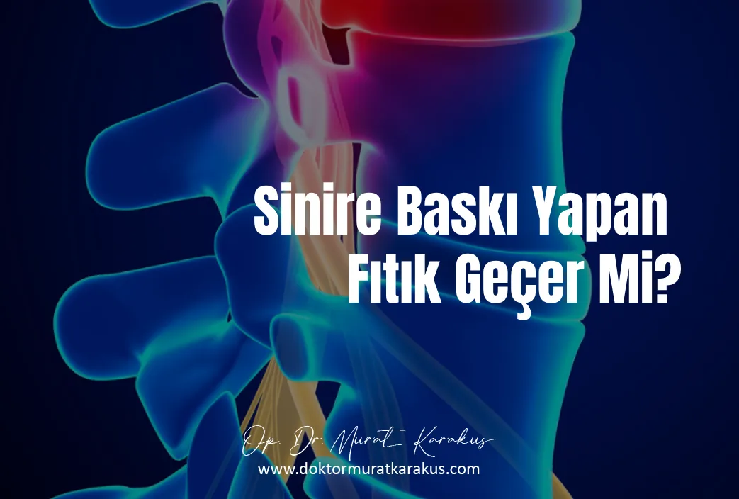 sinire-baski-yapan-fitik-gecer-mi